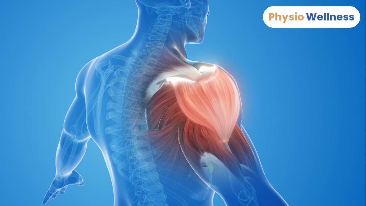 Anatomical illustration of the shoulder muscles and joint, highlighting the area affected by a frozen shoulder