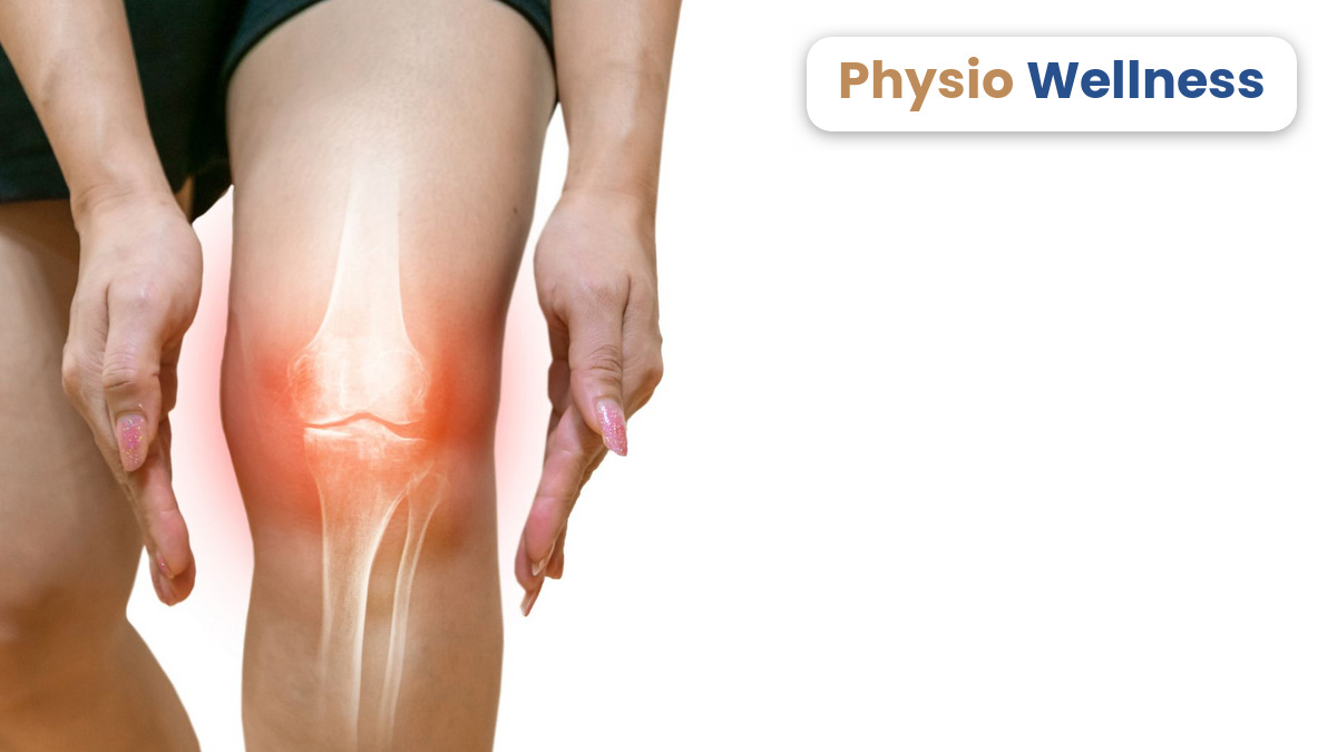 Illustration of the knee joint highlighting where osteoarthritis pain is felt