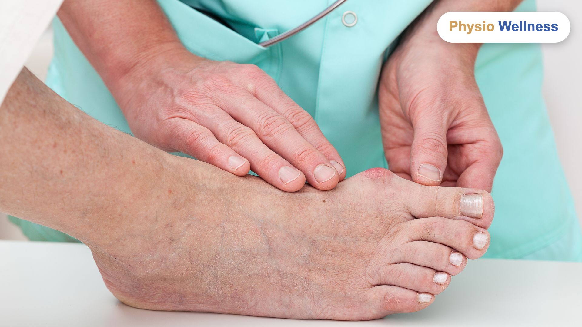 Hallux Limitus in Etobicoke: The Stiff, Aching Big Toe Explained